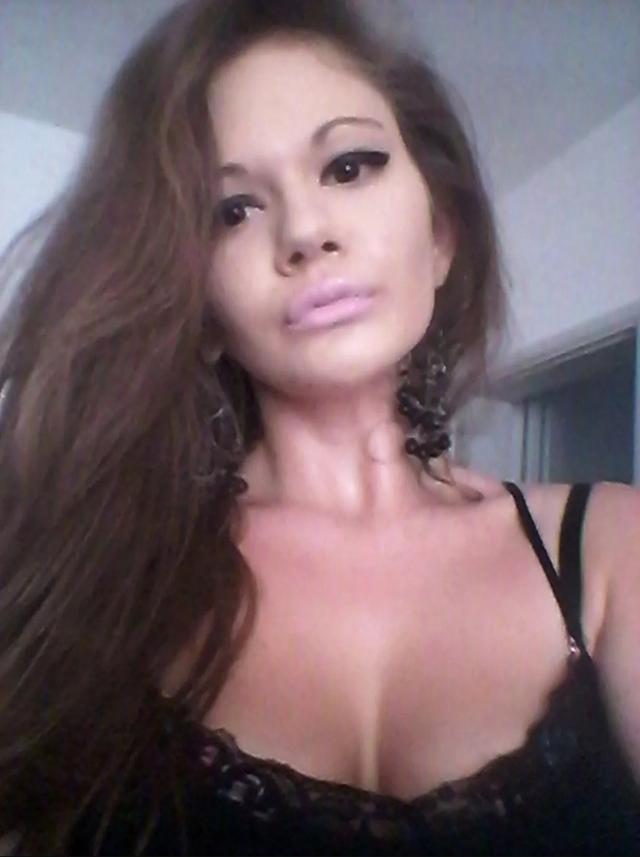 妹子丰唇27次，香肠嘴已经不足以形容了！疯狂到一天打6针